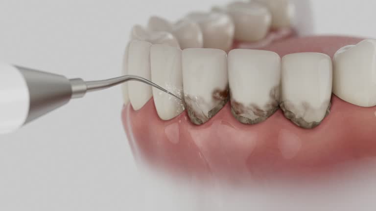Trusted Wisdom Tooth Removal service in El Rio, CA - Dentist Open Now